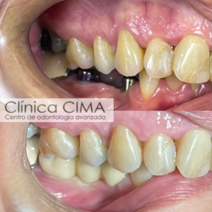 Clínica CIMA Implantología Centro de Odontologia Avanzada