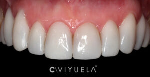 Clínica Dental CRISTINA VIYUELA + CO - ZURBANO