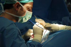 Dr. Gustavo Sordo. Rinoplastia Ultrasónica y Aumento de Pecho en Madrid