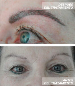 Micropigmentación Madrid - Rocisa Belleza S.L. -