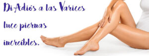 Varices sin Cirugía Madrid
