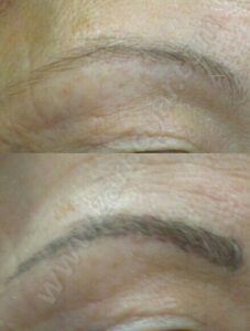 Zarnogar Micropigmentación Capilar - Microblading de Cejas en Madrid - Tatuaje