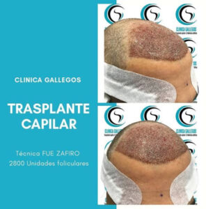 Clínica Gallegos