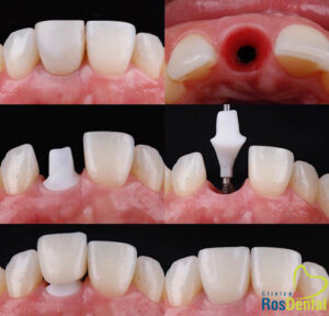 Clínica Ros Dental