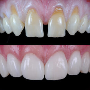 CIMA Clínica Dental en Madrid Implantes Dentales, Ortodoncia, Carillas Dentales y Periodoncia