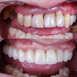 Clínica MAG Dental Madrid - Dentista Hortaleza