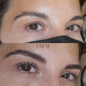 Centro de Estética Madrid Ángela Gómez EDLM