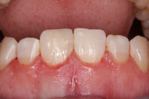 Clínica Dental Madrid Río